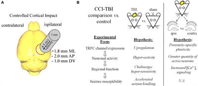 Blockade of TRPC Channels Limits Cholinergic-Driven Hyperexcitability and Seizure Susceptibility After Traumatic Brain Injury